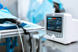 Picture of a monitor next to a hospital bed.